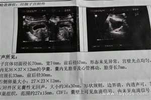武汉有谁愿意代生，2022年武汉第三代试管婴儿费用大概要多少钱?附武汉医院试